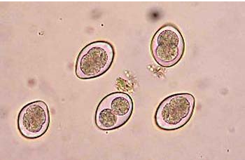 Coccidiosis in Poultry